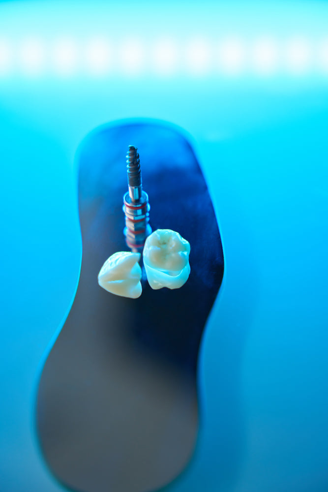 Immagine dedicata a implantologia dentale